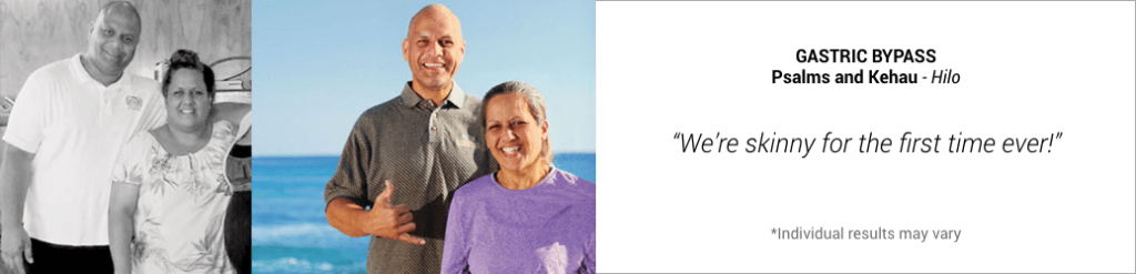 Side-by-side images of couple Psalms and Kehau before and after loosing weight through gastic bypass
